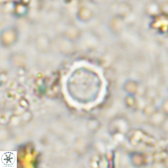 Cylindralithus crassus VR 21159