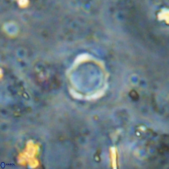 Cylindralithus crassus VR 21160