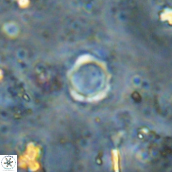 Cylindralithus crassus VR 21160