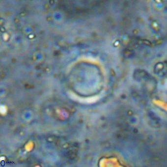 Cylindralithus crassus VR 21161