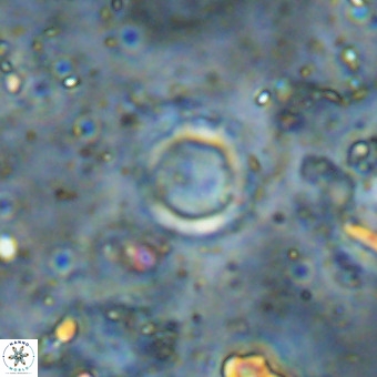 Cylindralithus crassus VR 21161