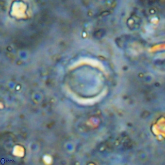 Cylindralithus crassus VR 21162