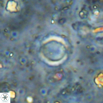 Cylindralithus crassus VR 21162
