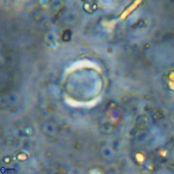 Cylindralithus crassus VR 21163