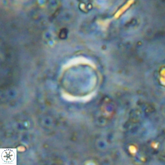 Cylindralithus crassus VR 21163
