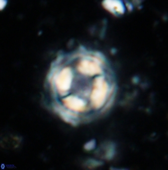 Cylindralithus sculptus 1170