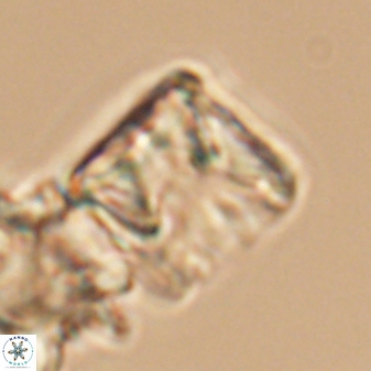 Cylindralithus sculptus 11863