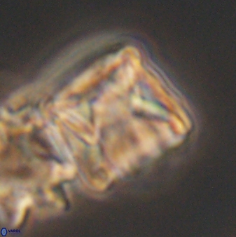 Cylindralithus sculptus 11864