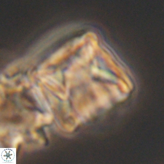 Cylindralithus sculptus 11864