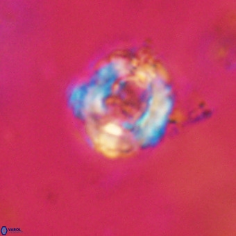 Cylindralithus serratus VR 22896