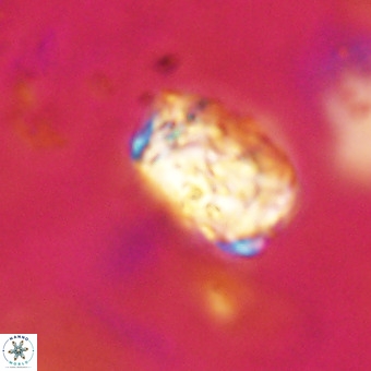 Cylindralithus serratus VR 22904