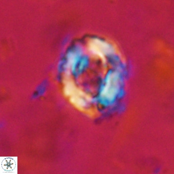 Cylindralithus serratus VR 22907