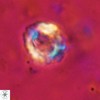Cylindralithus serratus VR 22910