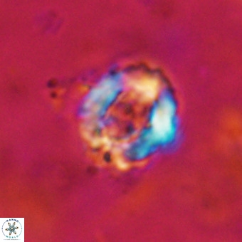 Cylindralithus serratus VR 22912