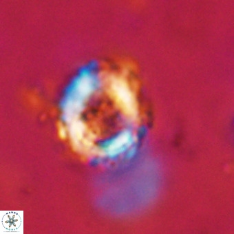 Cylindralithus serratus VR 22916