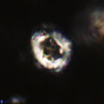 Cylindralithus serratus VR 22919