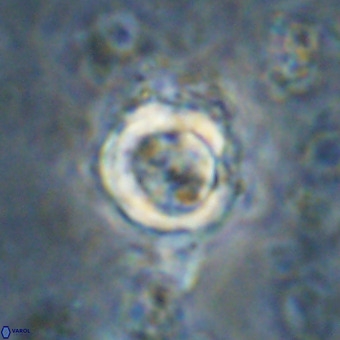 Cylindralithus sp A VR 21506