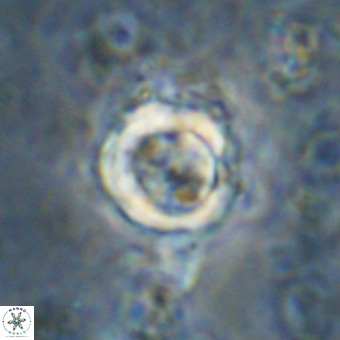 Cylindralithus sp A VR 21506