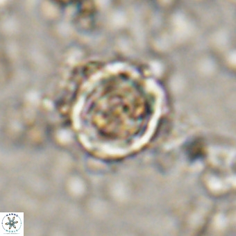 Cylindralithus sp A VR 21501