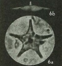 Discoaster sublodoensis VR 025580