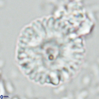 Davidbukrya claracirculus 26149