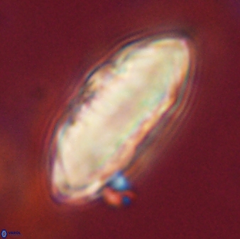 Davidbukrya claracirculus 59349