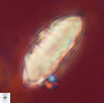 Davidbukrya claracirculus 59349