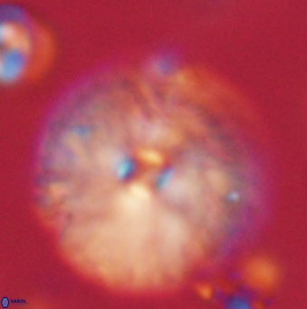 Davidbukrya claracirculus 59693