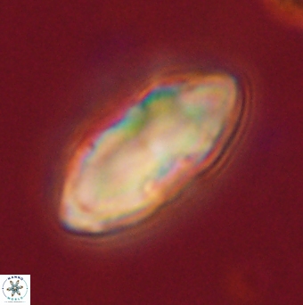 Davidbukrya claracirculus 59703