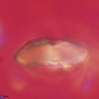 Davidbukrya claracirculus 59715