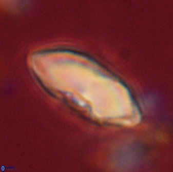 Davidbukrya claracirculus 59716