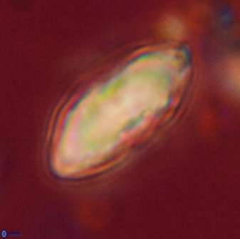 Davidbukrya claracirculus 59719