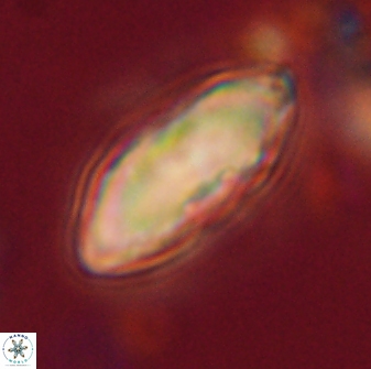Davidbukrya claracirculus 59719