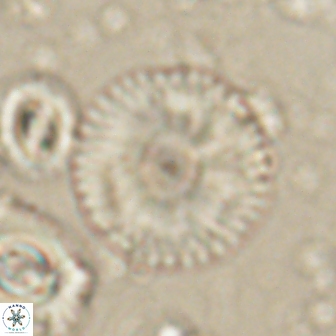 Davidbukrya claracirculus 60242