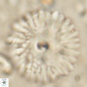 Davidbukrya clemencesalleyae 60010