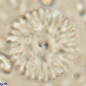 Davidbukrya clemencesalleyae 60011