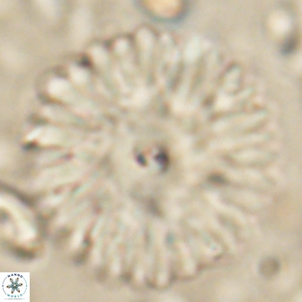 Davidbukrya clemencesalleyae 60011
