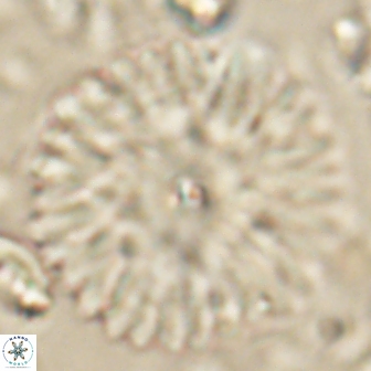 Davidbukrya clemencesalleyae 60012