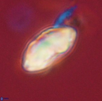 Davidbukrya perchnielseniae 52581