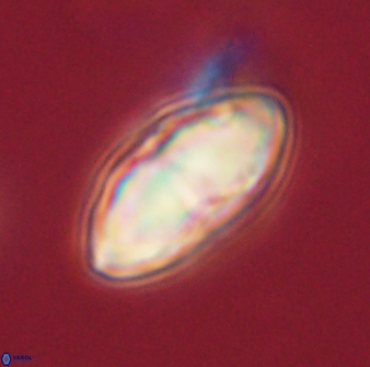 Davidbukrya perchnielseniae 52585