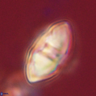 Davidbukrya perchnielseniae 52610