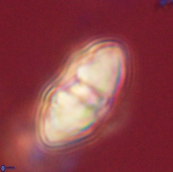 Davidbukrya perchnielseniae 52614