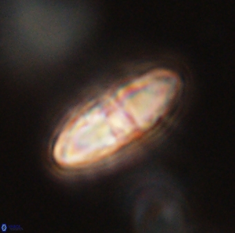 Davidbukrya perchnielseniae 55641