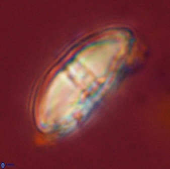 Davidbukrya perchnielseniae 58125