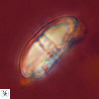 Davidbukrya perchnielseniae 58125
