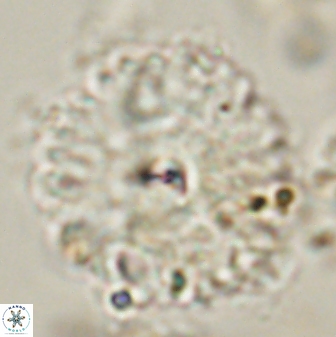 Davidbukrya perchnielseniae 58140