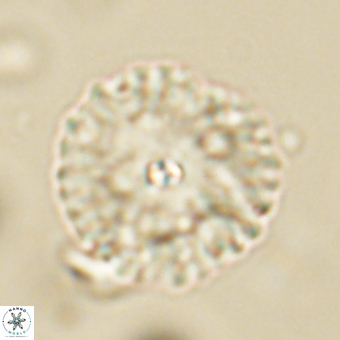 Davidbukrya perchnielseniae 69759