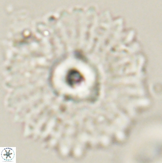 Davidbukrya protomultiradiatus 58599