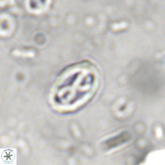 Davidhakania partingtonii VR 448