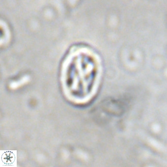 Davidhakania partingtonii VR 451